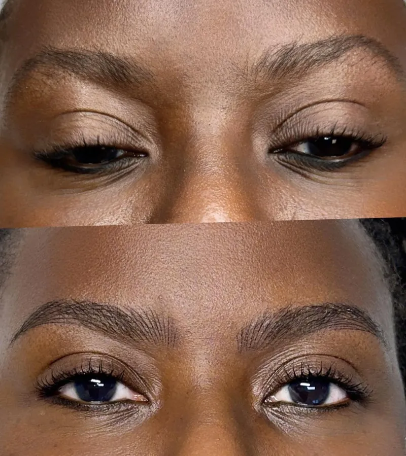 Des sourcils avant et après une séance de NanoBrows